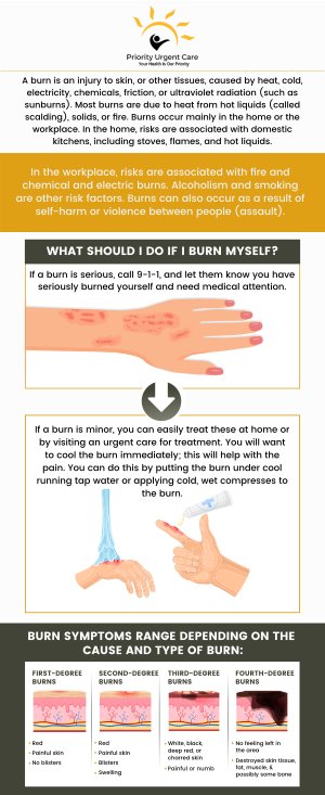 A burn of the first degree is a minor burn that exclusively affects the skin's surface. Minor burns cause redness, pain, and swelling. If you have a first-degree burn and are unsure of how to treat it, our experienced professionals will help you feel better. For more information, please contact us or book an appointment online. We have convenient locations to serve you in Cromwell, CT, East Haven, CT, Ellington, CT, Newington, CT, Oxford, CT, Unionville, CT and Wallingford, CT. A burn of the first degree is a minor burn that exclusively affects the skin's surface. Minor burns cause redness, pain, and swelling. If you have a first-degree burn and are unsure of how to treat it, our experienced professionals will help you feel better. For more information, please contact us or book an appointment online. We have convenient locations to serve you in Cromwell, CT, East Haven, CT, Ellington, CT, Newington, CT, Oxford, CT, Unionville, CT and Wallingford, CT.