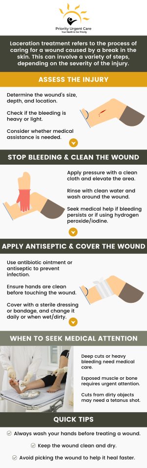 Have you suffered a cut, laceration, or puncture wound? Priority Urgent Care and Walk-In Clinic have experienced Doctors and professional medical staff who can provide specialized care for laceration repair for cuts and wounds. We are open 7 days a week. Walk in or contact us now. We have convenient locations to serve you in Cromwell, CT, East Haven, CT, Ellington, CT, Newington, CT, Oxford, CT, Unionville, CT and Wallingford, CT.