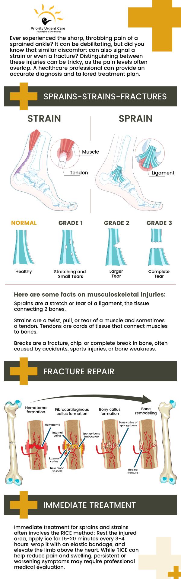 Signs and symptoms of fractures are sudden pain, trouble using or moving the injured area or nearby joints, unable to bear weight, swelling, and obvious deformity. At Priority Urgent Care & Walk In Clinic, our experienced Doctors and medical professionals can treat all kinds of minor fractures. We are equipped to handle all your medical needs, and there is no need to make an appointment - just walk in! We serve children, adults, and seniors seven days a week. For more information, contact us today. We have convenient locations to serve you in Cromwell, CT, East Haven, CT, Ellington, CT, Newington, CT, Oxford, CT, Unionville, CT and Wallingford, CT. Signs and symptoms of fractures are sudden pain, trouble using or moving the injured area or nearby joints, unable to bear weight, swelling, and obvious deformity. At Priority Urgent Care & Walk In Clinic, our experienced Doctors and medical professionals can treat all kinds of minor fractures. We are equipped to handle all your medical needs, and there is no need to make an appointment - just walk in! We serve children, adults, and seniors seven days a week. For more information, contact us today. We have convenient locations to serve you in Cromwell, CT, East Haven, CT, Ellington, CT, Newington, CT, Oxford, CT, Unionville, CT and Wallingford, CT.